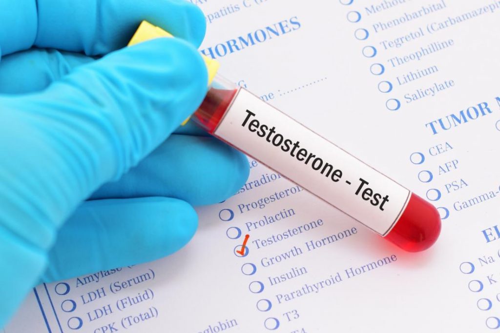 What Are Normal Testosterone Levels For A Man?